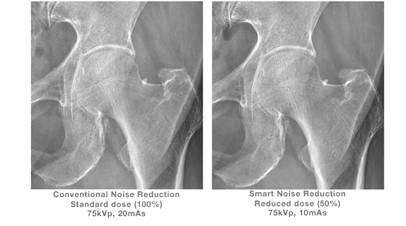 Smart Noise Reduction   
